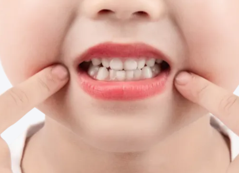 涂氟后多久能刷牙？河北惟德口腔醫(yī)生專(zhuān)業(yè)答疑