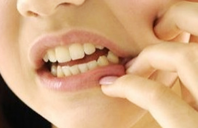 突發(fā)性、自發(fā)性的劇烈牙疼