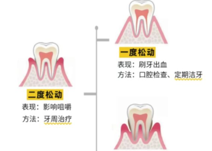老年人牙齒松動(dòng)了要怎么辦？