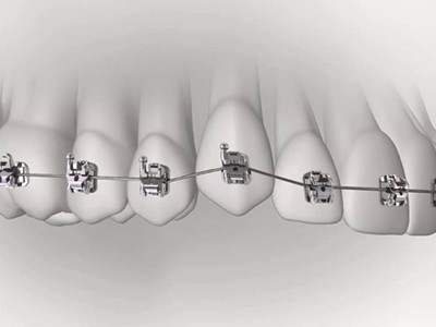 承德市哪家口腔醫(yī)院口腔正畸做得好？惟德口腔醫(yī)院來(lái)告訴您