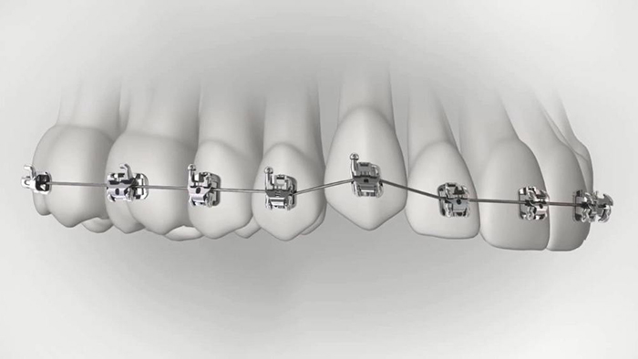 承德市哪家口腔醫(yī)院口腔正畸做得好？惟德口腔醫(yī)院來告訴您