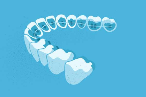 惟德口腔醫(yī)院口腔正畸好不好？